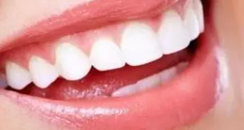 دندانپزشکی , دندانسازی , علی آقایی