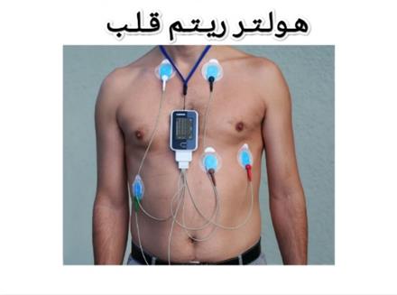 اجاره هولتر ریتم قلب در مشهد