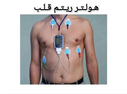 اجاره هولتر ریتم قلب در مشهد
